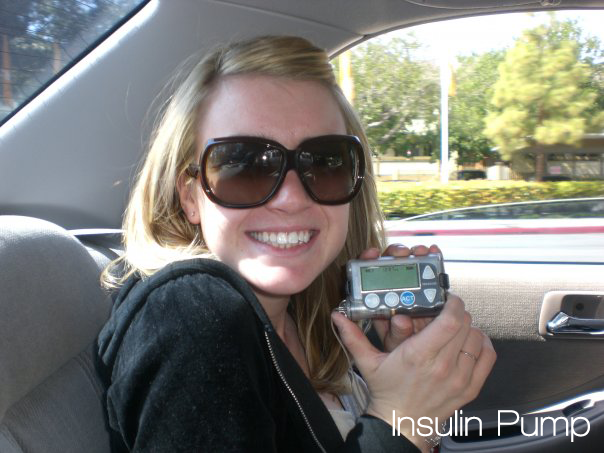 Insulin Pump - Photo - 3